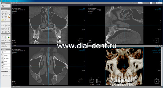 Xelis Dental-CDViewer-3D