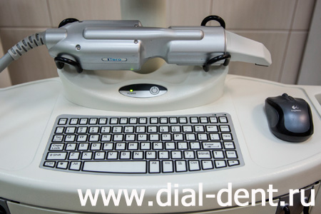 iTero - цифровой сканер для создания оттиска зубов