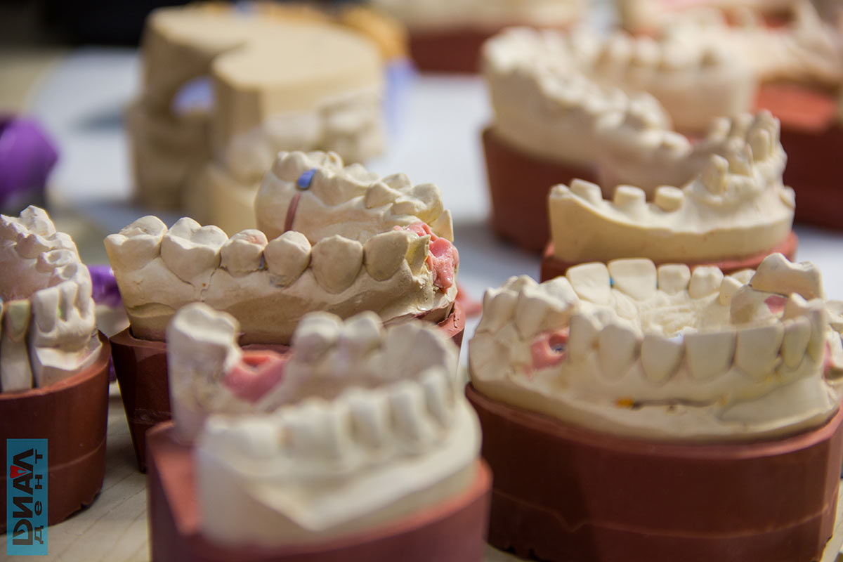 модели челюстей в зуботехнической лаборатории Диал-Дент