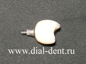 коронка зубная для протезирования на импланте