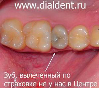 боль в зубе после лечения по программе Стоматология ДМС
