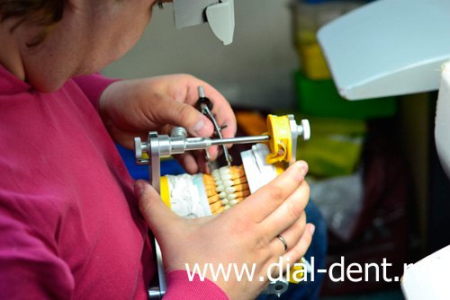 изготовление коронок в зуботехнической лаборатории "Диал-Дент"
