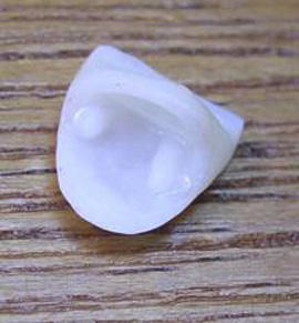 безметалловая керамическая коронка на зуб