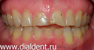 вид зубов при обращении в клинику
