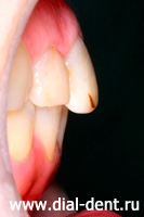 вид зубов при обращении