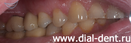 лечение и протезирование зубов в "Диал-Дент"