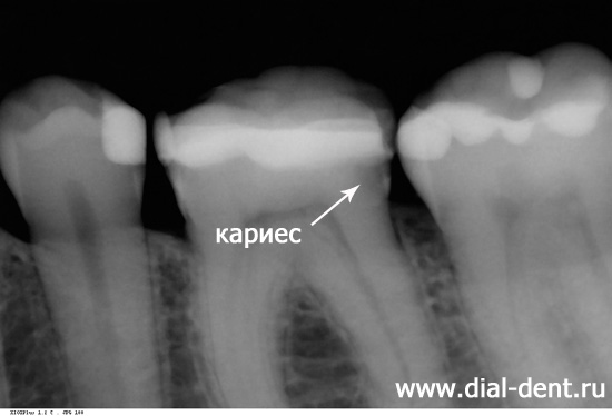 рентген зубов в Диал-Дент