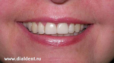 улыбка довольной пациентки стоматологической клиники Диал-Дент