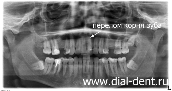 панорамный снимок зубов при обращении
