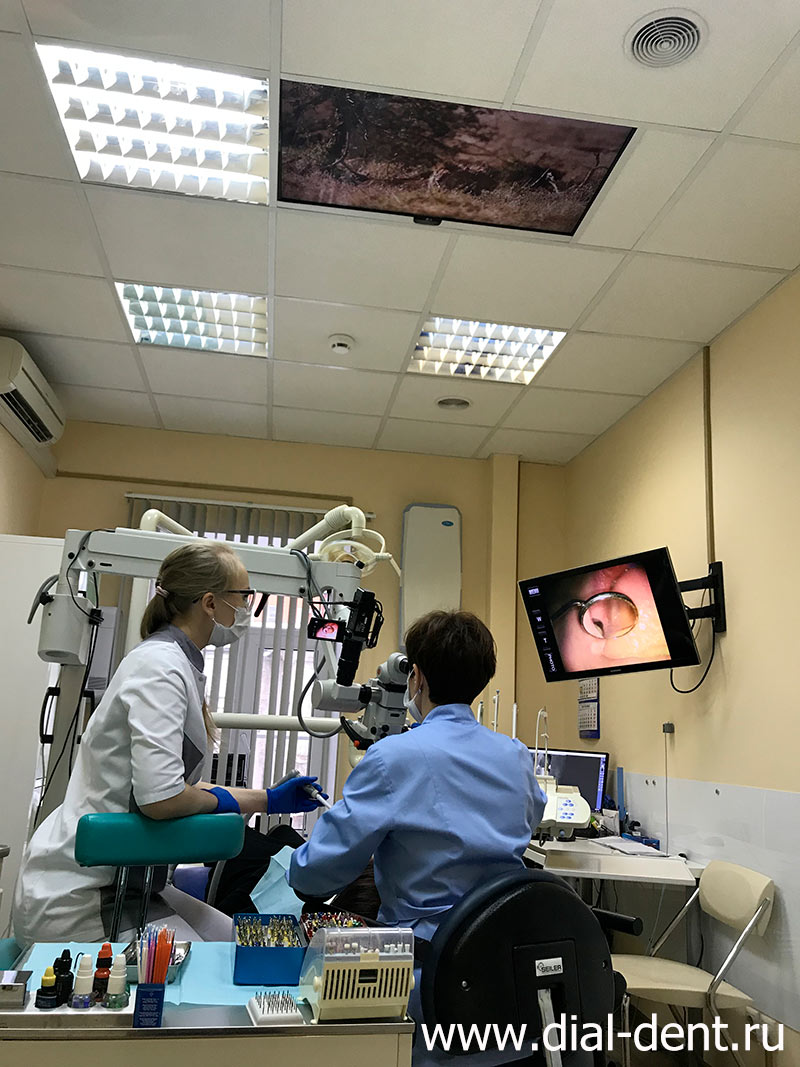 лечение зубов с микроскопом проводит стоматолог-эндодонтист Т.И. Матиенко