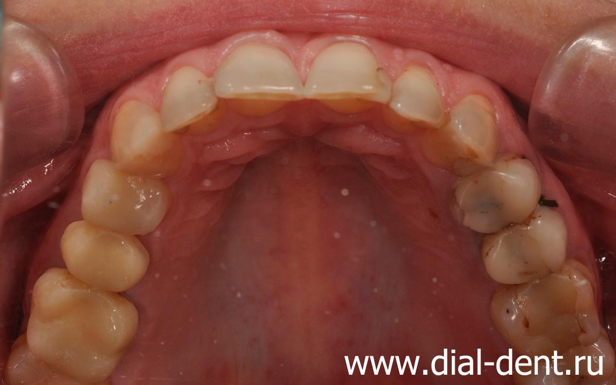 состояние зубов при обращении