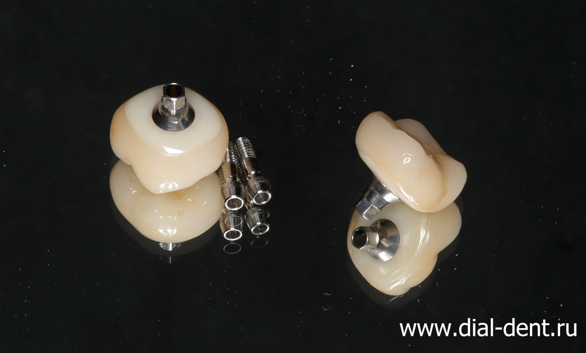зубные коронки на импланты с винтовым креплением