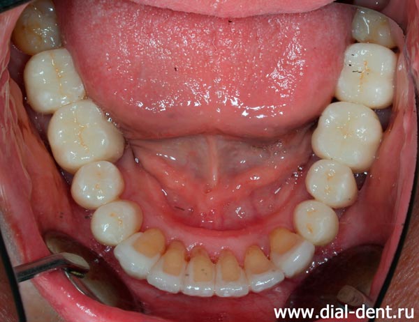 результат комплексного стоматологического лечения