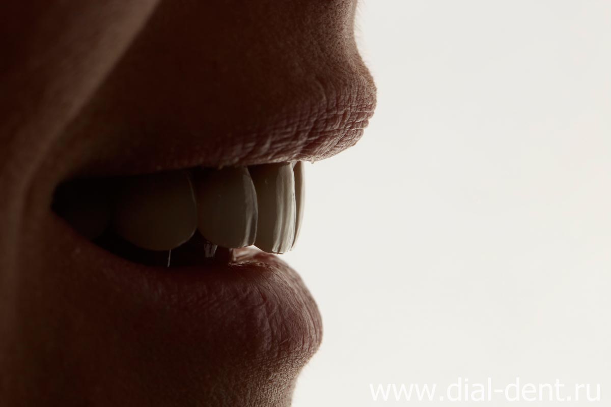 эстетичное протезирование зубов в Диал-Дент