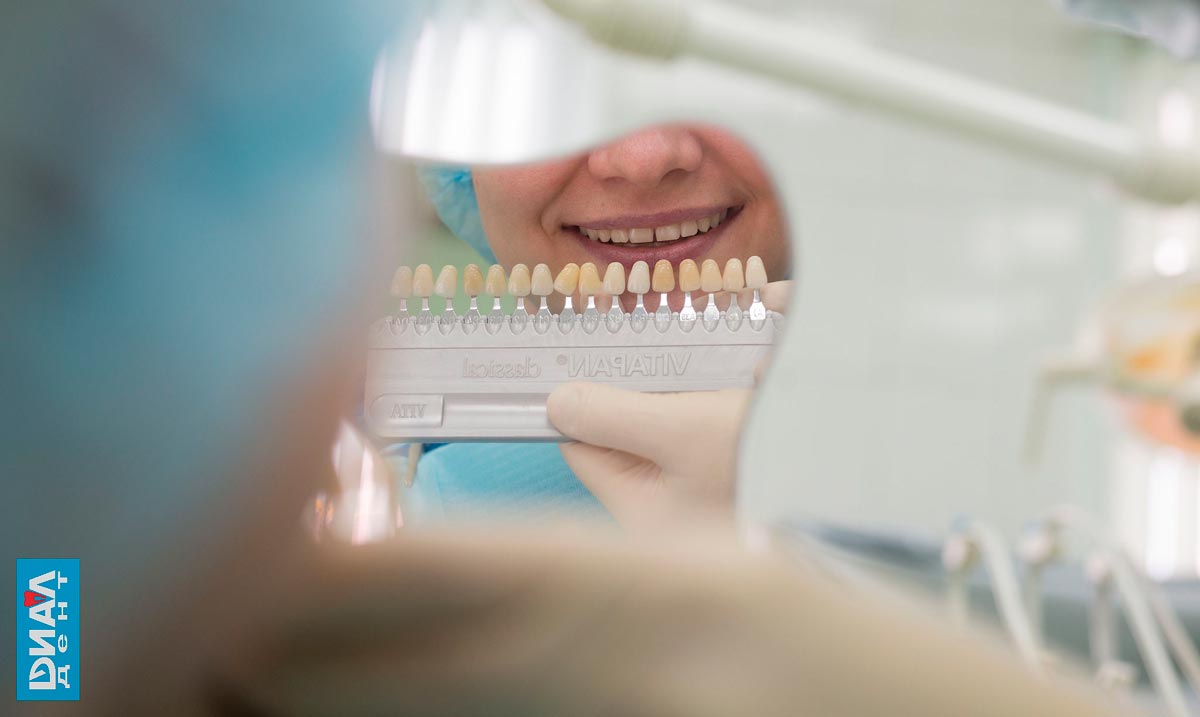 определение цвета перед отбеливанием зубов в Диал-Дент