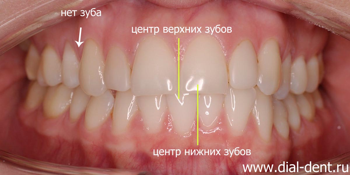 вид зубов при обращении в клинику
