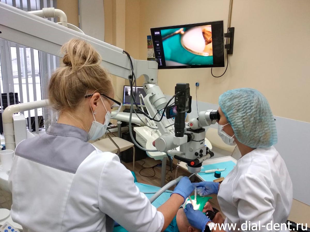 лечение зубов под микроскопом в Диал-Дент