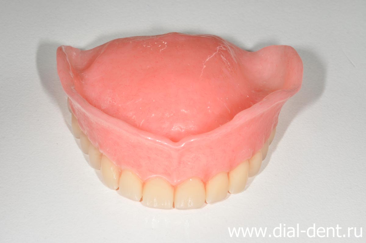 съемный зубной протез верхних зубов