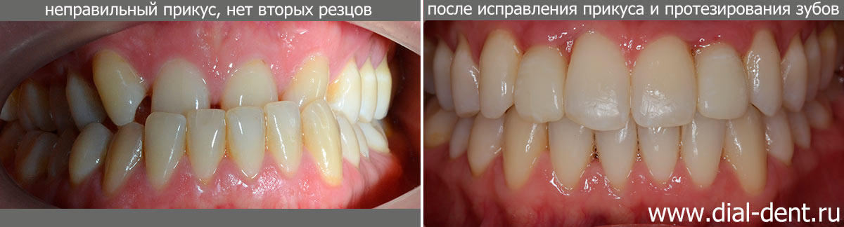 Почему у ребенка не растут зубы - Стоматология «НоваДэнт»