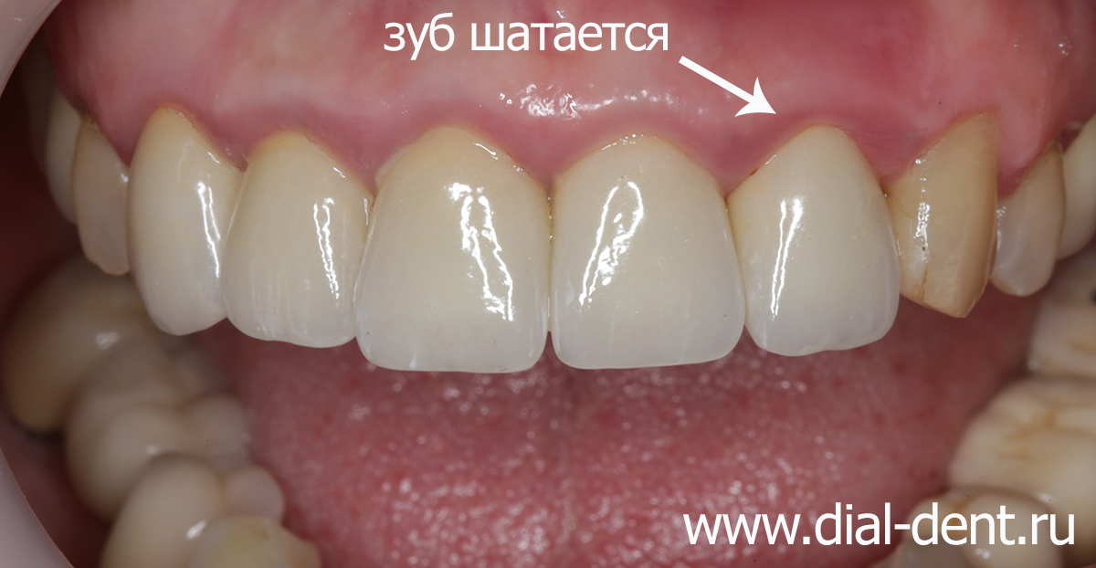 фото зуба при обращении