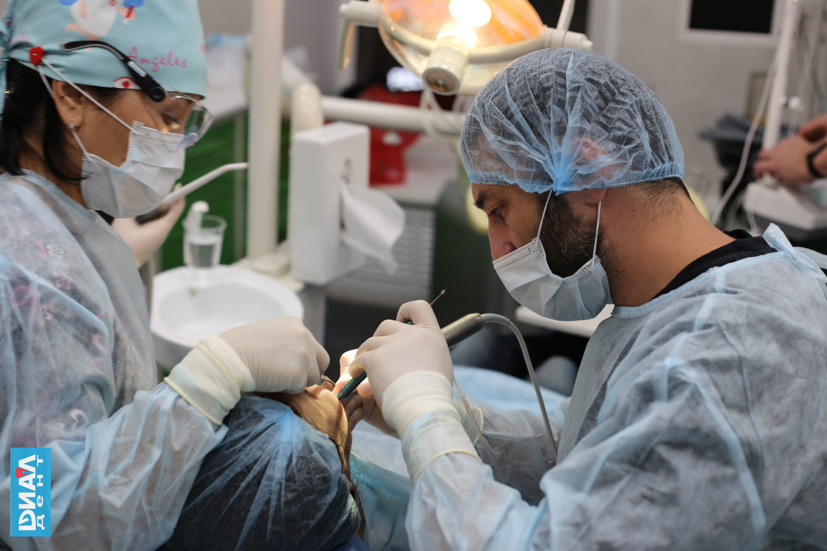 удаление и имплантация зубов в седации