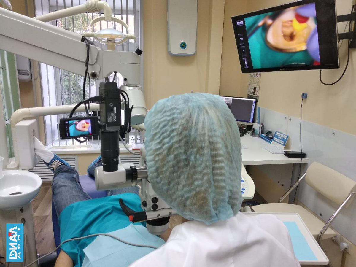 лечение зубов с микроскопом в Диал-Дент