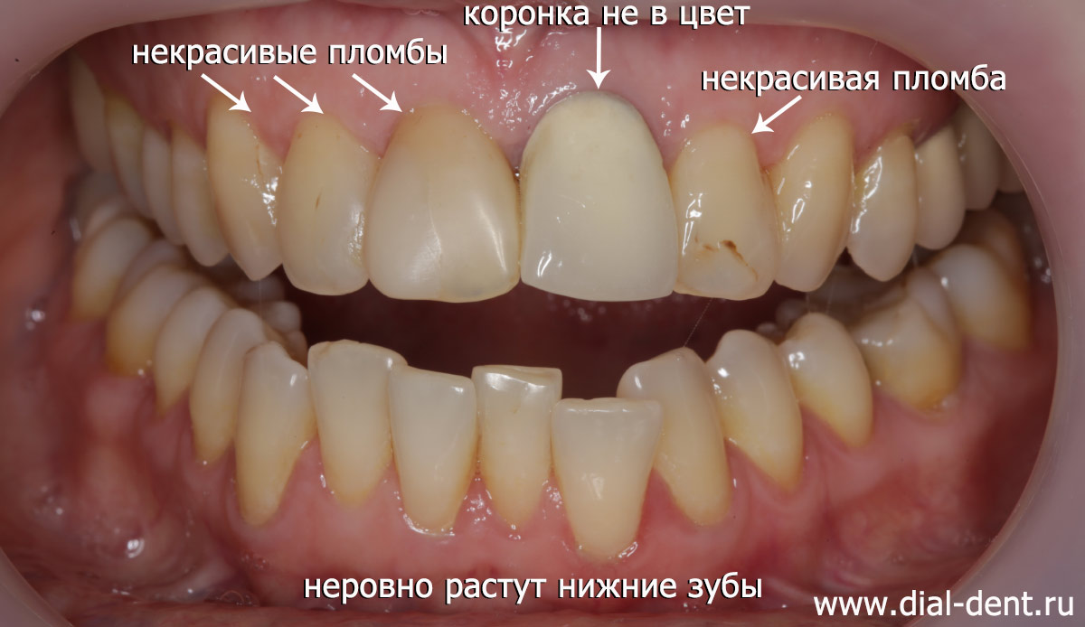проблемы с зубами при обращении