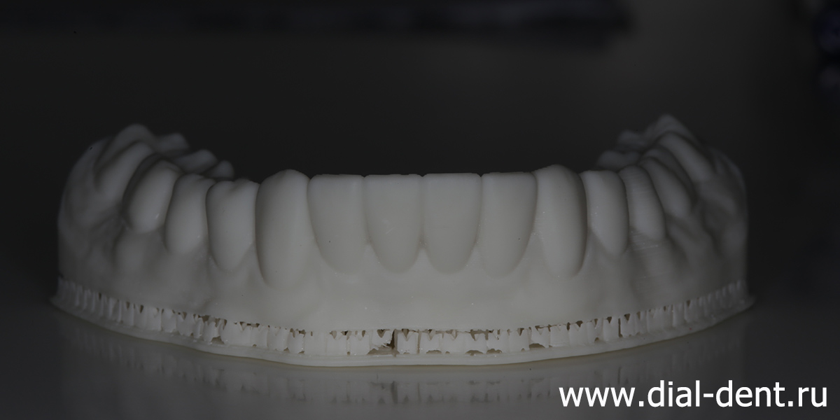 моделирование реставрации нижних зубов