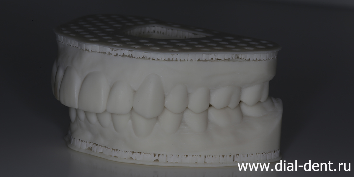 высокоточные модели для подготовки к реставрации передних зубов