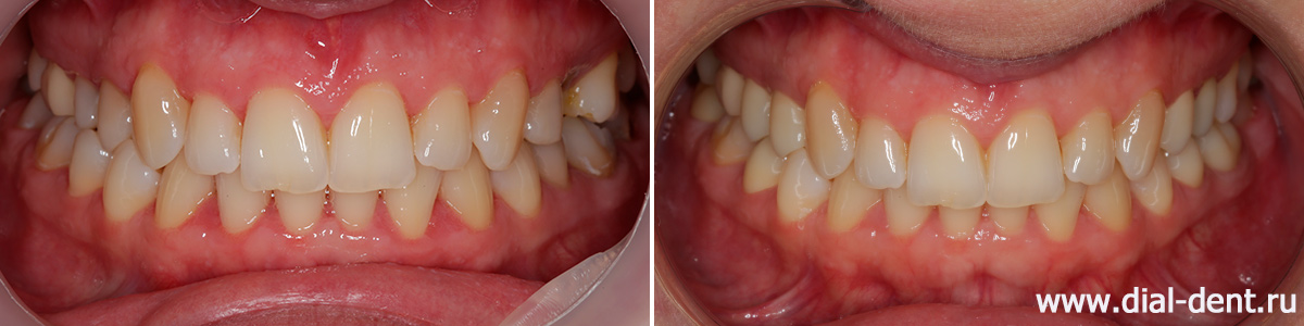 лечение и протезирование зубов в Диал-Дент