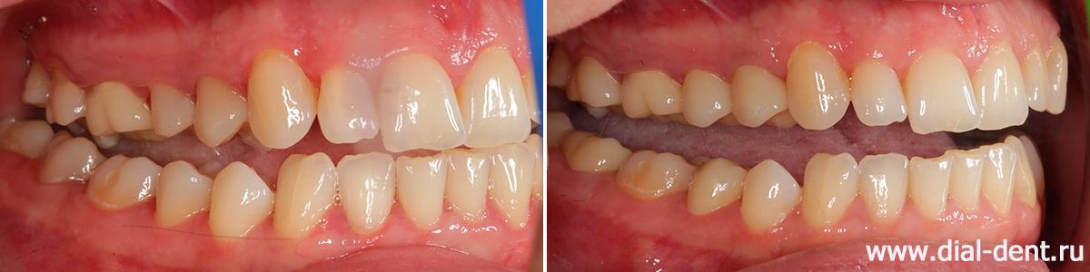 лечение и протезирование зубов в Диал-Дент