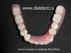 съемный зуб протез очищен в клинике "Диал-Дент" с помощью аппарата MicroClean