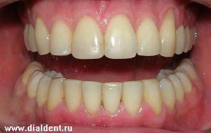 проведено комплексное стоматологическое лечение специалистами клиники "Диал-Дент"