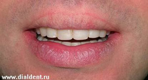 проведено комплексное стоматологическое лечение специалистами клиники "Диал-Дент"