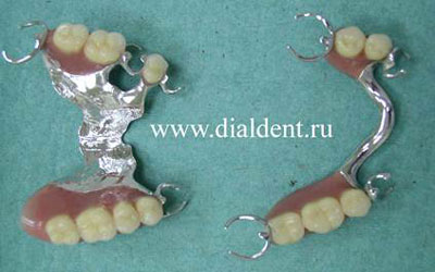 бюгельные протезы изготовлены в зуботехнической лаборатории "Диал-Дент"