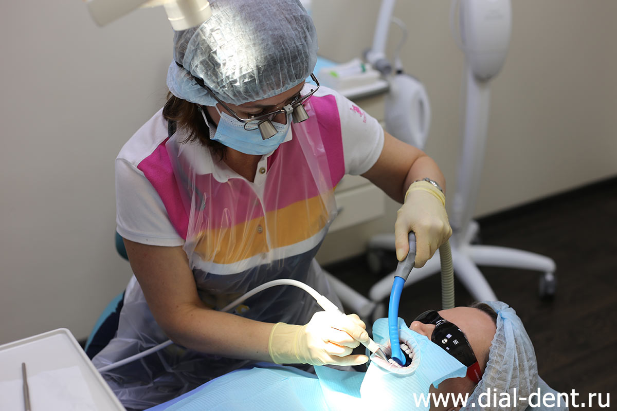 гигиена зубов в Диал-Дент