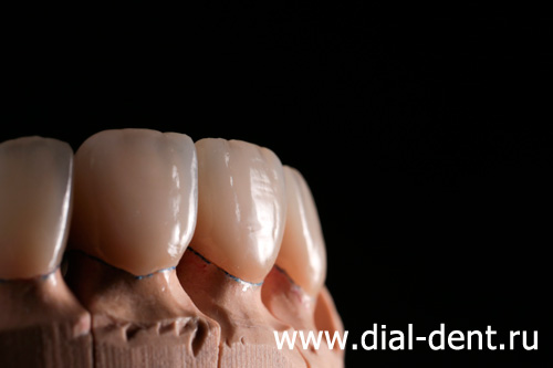протезирование передних зубов керамическими коронками
