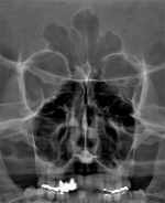 рентген-диагностика в ортодонтии