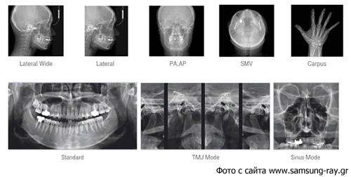 ТРГ, КТ, панорамный снимок зубов