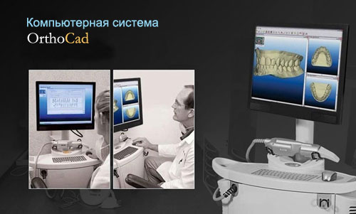OrthoCad - 3D ортодонтия