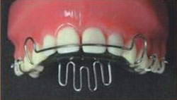 пластинка с заслонкой против прокладывания языка между зубами