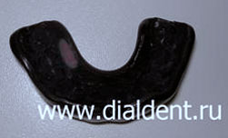 защитная зубная капа изготовленная в Диал-Дент