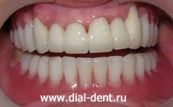 проведено протезирование зубов