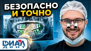 Имплантация зубов при отсутствии всех зубов в челюсти