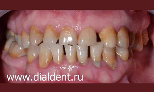 После_6