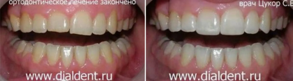 Комплексные эстетические работы в "Диал-Дент" с привлечением разных специалистов