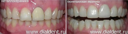 "Диал-Дент" исправляет ошибки других клиник
